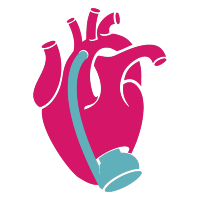 Mechanical Circulatory Support (MCS)