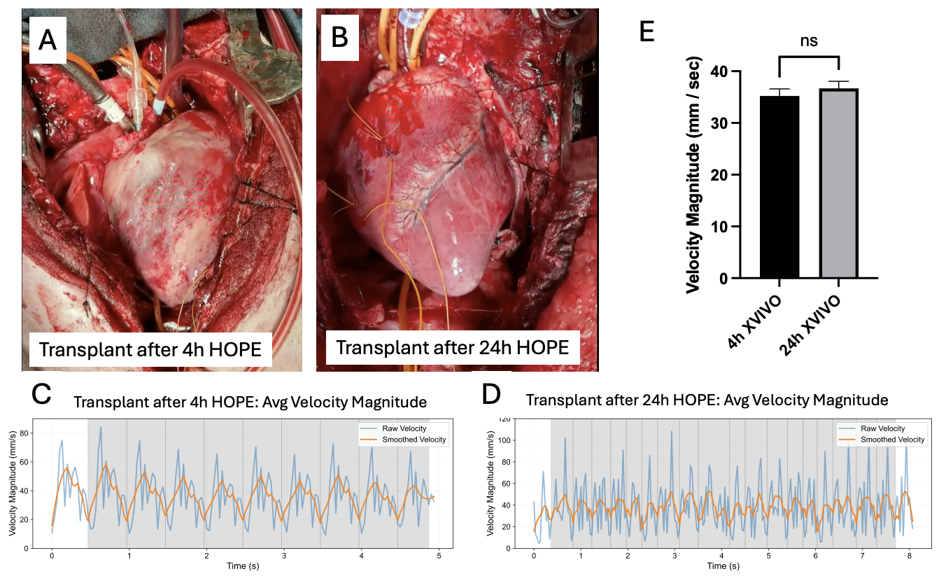 Featured Poster Presentation Graphic from Poster 438
