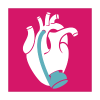 Mechanical Circulatory Support (MCS)